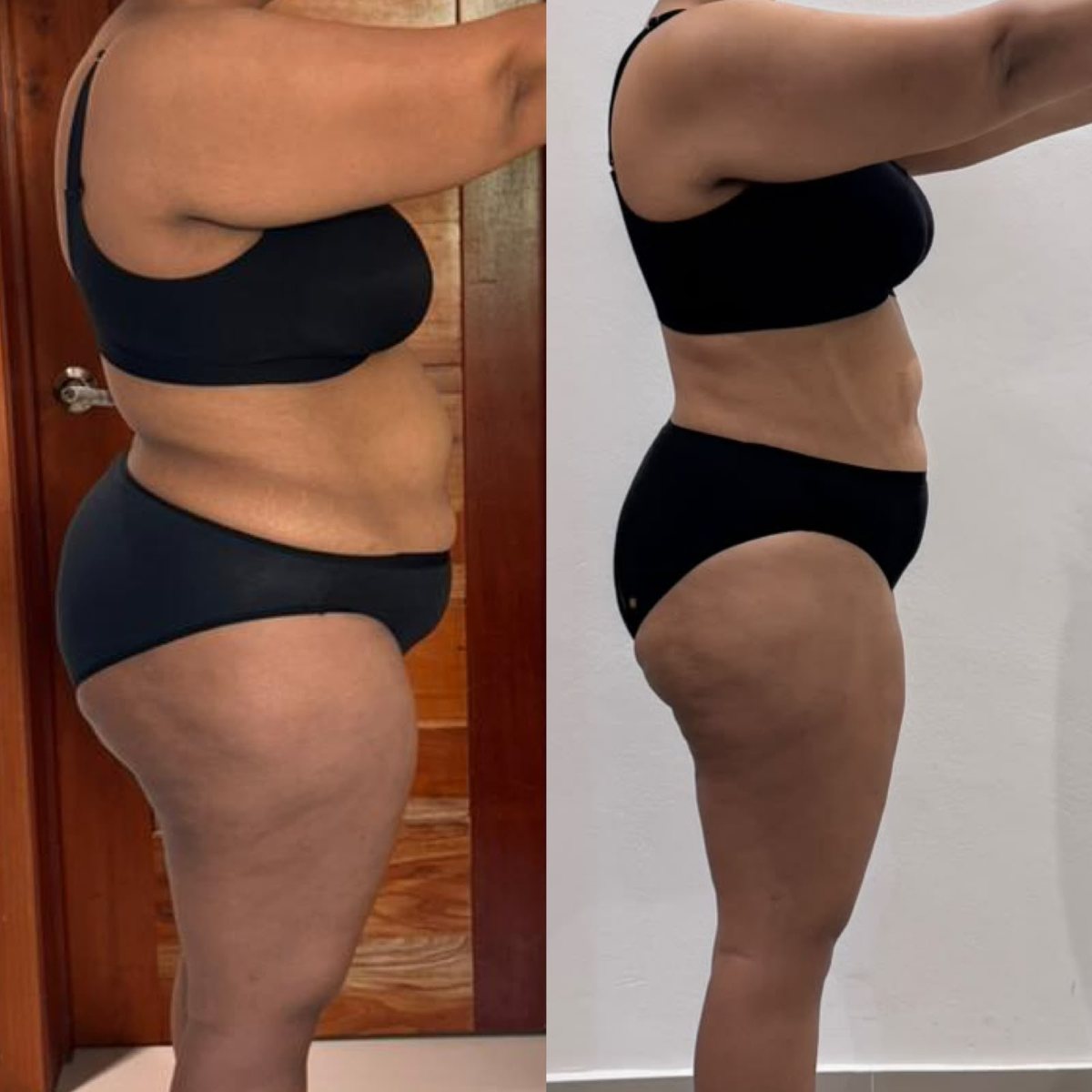 Antes y después de una alumna, vista de lado