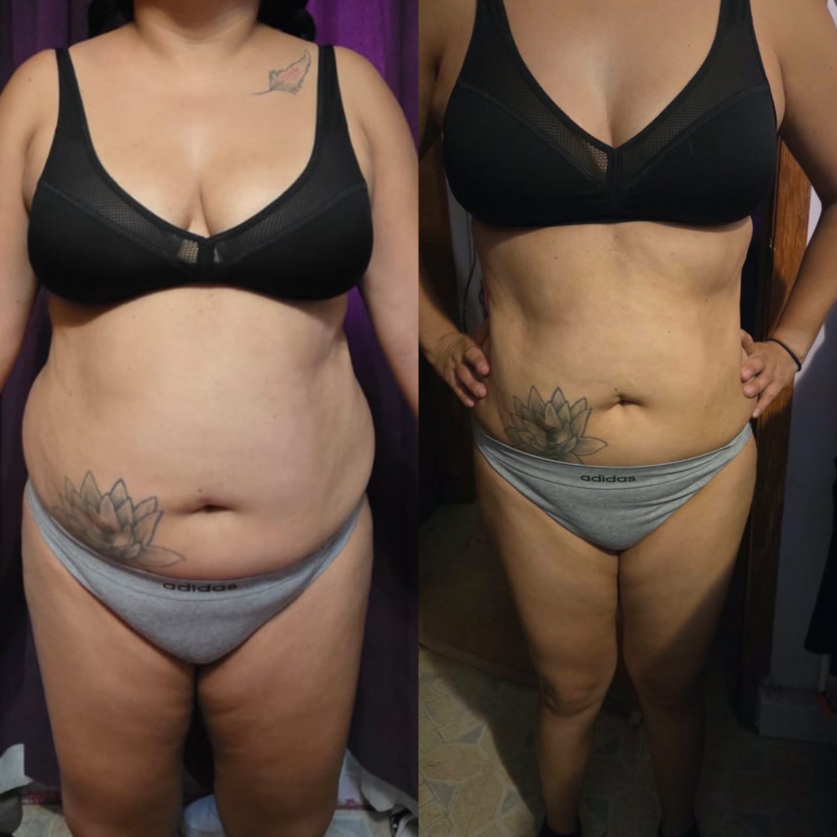 Antes y después de una alumna, vista de frente
